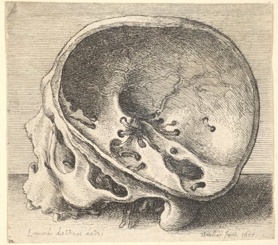 頭蓋骨の左側が取り除かれた、左側が横から見た断面の頭蓋骨、1651年。 作： Wenceslaus Hollar