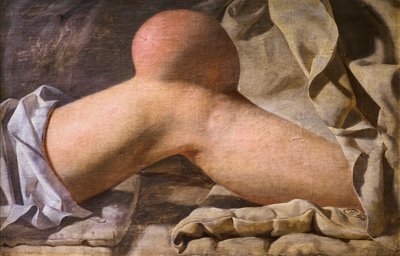 膝蓋靱帯の腫れ [膝］ 作： ヴィルヘルム・フェルディナンド・ベンツ