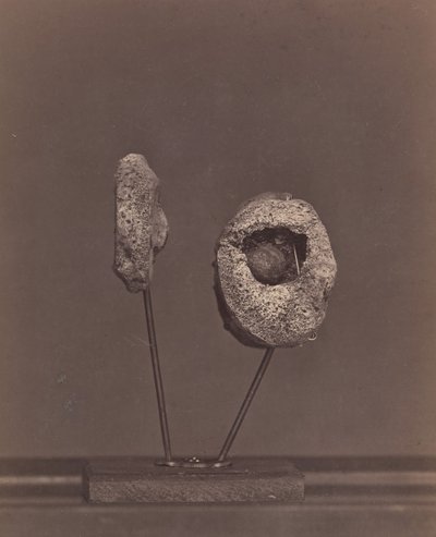 摘出された膝関節。右大腿骨内顆にマスケット銃の丸い玉［Gardin..., 1866-67. 作： William H. Bell