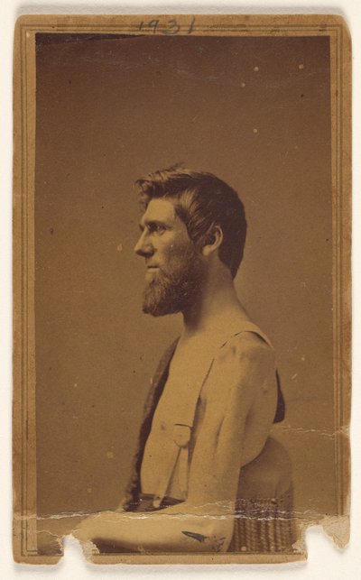 [南北戦争の犠牲者の横顔（座った状態）。 作： William H. Bell