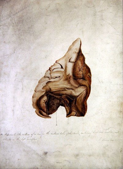 脳の習作 I, c.1850 （水彩・紙） 作： William Lover
