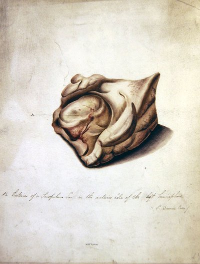 脳の研究II」1850年頃（紙に水彩画） 作： William Lover