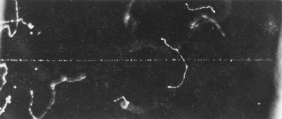 粒子イメージング、クラウドチェンバー 高速ベータ線の軌跡、20世紀初頭 作： Ferdinand Georg Waldmuller
