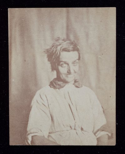 精神医学 患者の肖像、サリー・カウンティ・アサイラム、1852年頃 作： John Pardon