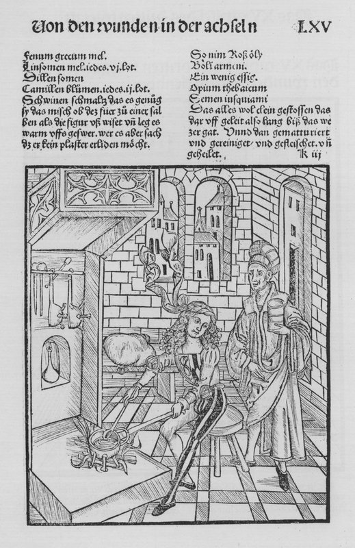 ヒエロニムス・ブルンシュウィグの「Cirurgiaの書」（リトグラフ版 作： （後）ドイツ語学校