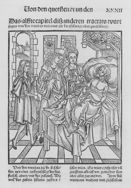 ヒエロニムス・ブルンシュウィグの「Cirurgiaの書」（リトグラフ版 作： （後）ドイツ語学校