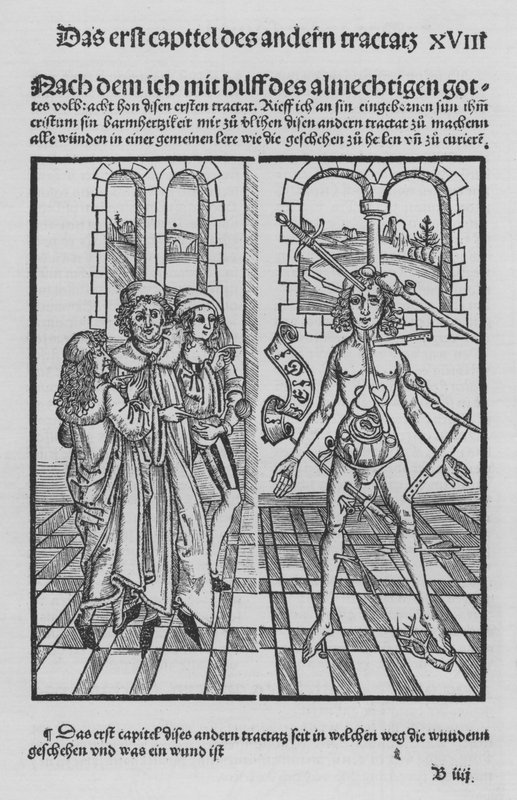 ヒエロニムス・ブルンシュウィグの「Cirurgiaの書」（リトグラフ版 作： （後）ドイツ語学校