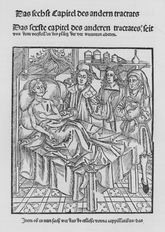 ヒエロニムス・ブルンシュウィグの「Cirurgiaの書」（リトグラフ版 作： （後）ドイツ語学校