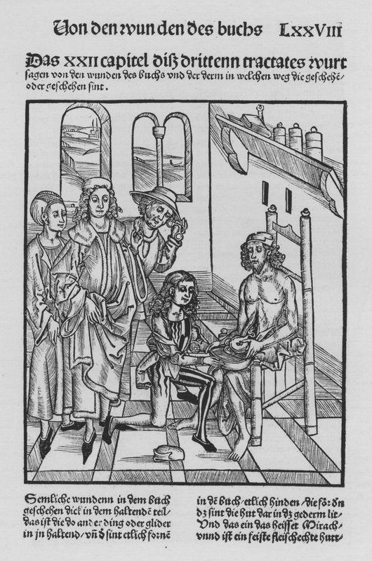 ヒエロニムス・ブルンシュウィグの「Cirurgiaの書」（リトグラフ版 作： （後）ドイツ語学校