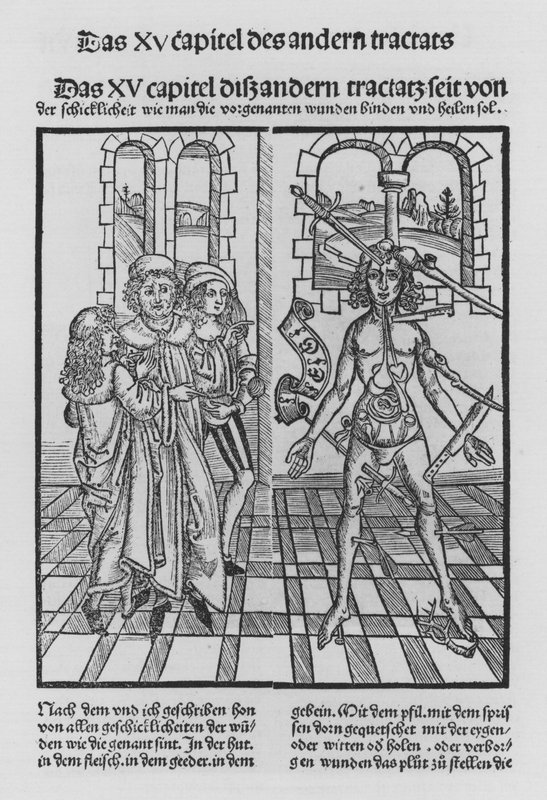 ヒエロニムス・ブルンシュウィグの「Cirurgiaの書」（リトグラフ版 作： （後）ドイツ語学校
