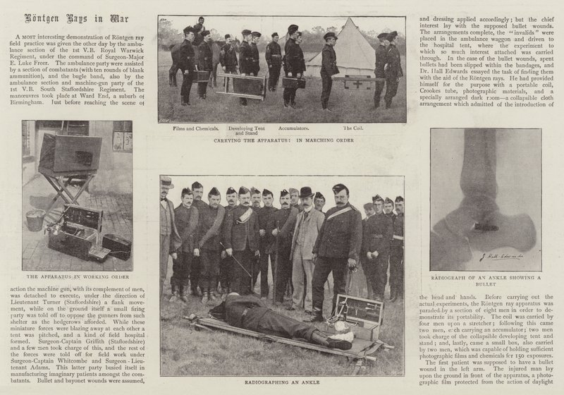 戦争中のレントゲン光線 作： 英語の写真家