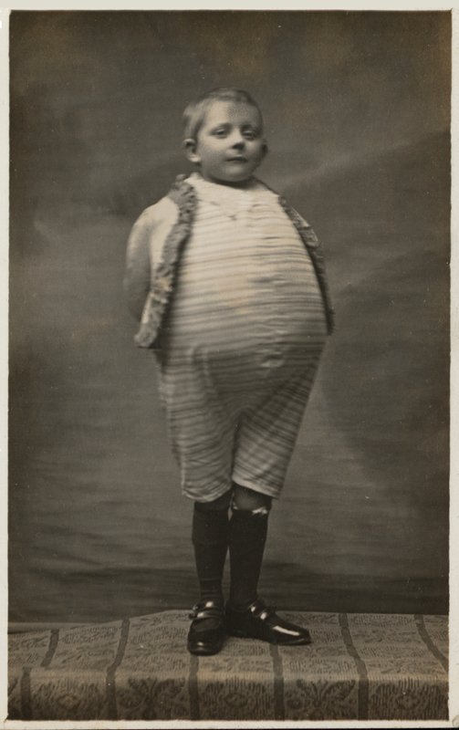 お腹がとても大きく見えるように着飾った小学生（モノクロ写真 作： 英語の写真家