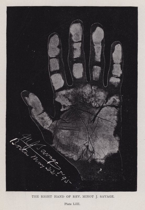 ミノット・J・サベージ師の右手（モノクロ写真 作： 英語の写真家