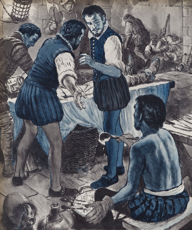 Ambroise Pare, cirurgião militar, quando o óleo acabou (litho) 作： 英語学校