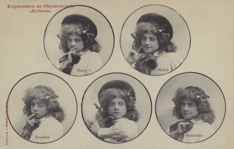 顔を引っ張る女の子（モノクロ写真 作： フランスの写真家