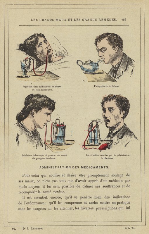 フードチューブによる薬剤の摂取、お茶による燻蒸、吸入ガス化装置によるバルサミコやガスの吸入、反応噴霧器による反応噴霧（カラーリトホ 作： フランス語学校