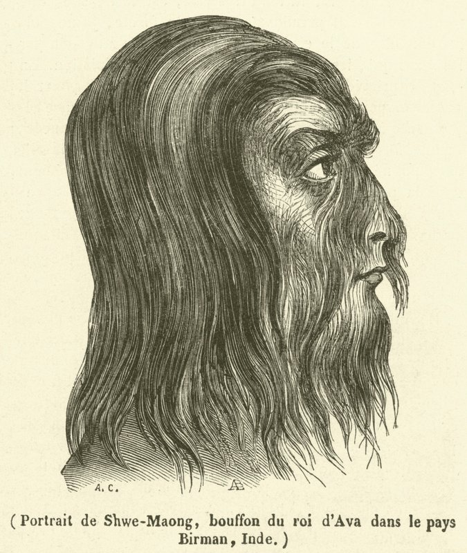 インド・ビルマのアバ王の道化師シュエ・マオンの肖像（彫刻作品 作： フランス語学校
