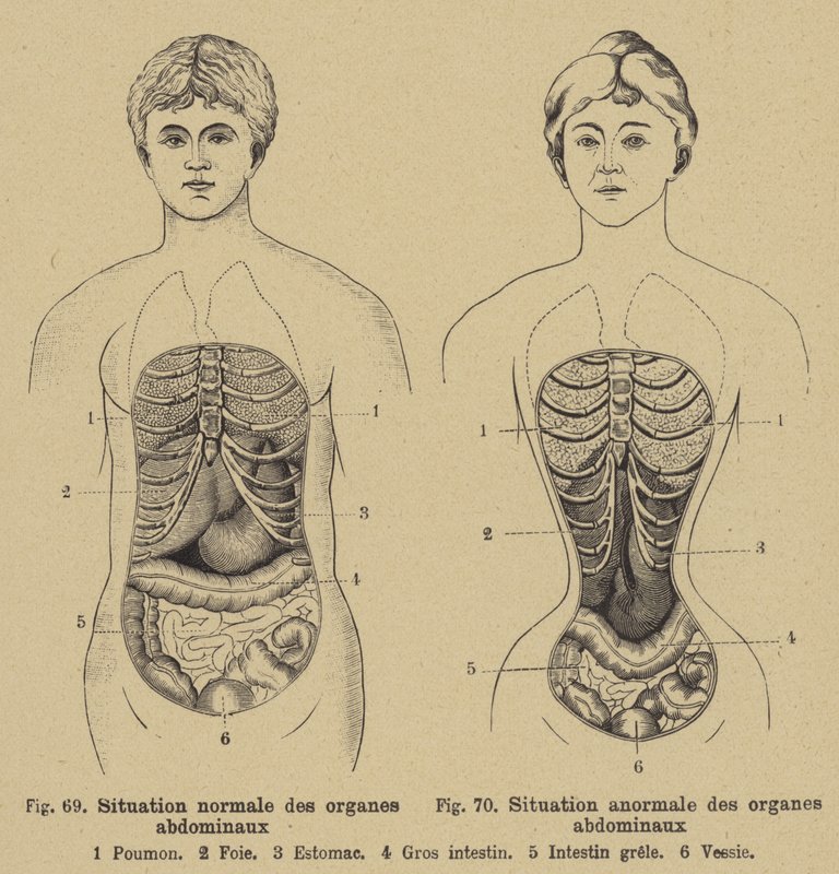 男性と女性の腹部の内臓の正常な状態 作： ドイツ語学校