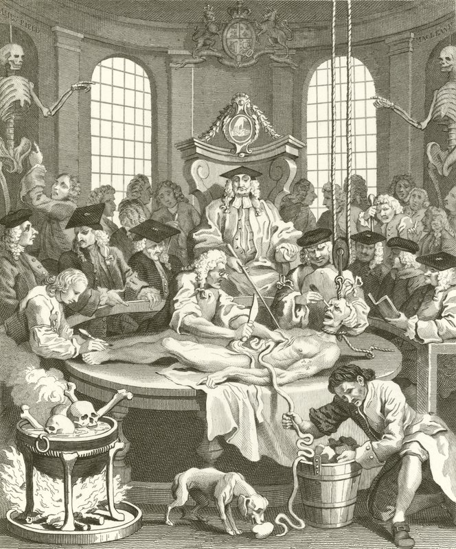 虐待の4つの段階 | アートプリント