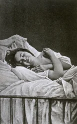 1878年にヒステリーの発作を起こした若い女性