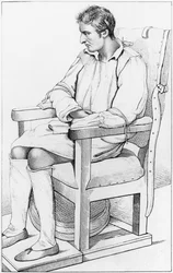エティエンヌエスキロール（1772-1840）1838による「Des Maladies Mentalesがdans le rapportの医療、衛生法および医療法的法律と見なした」からの認知症のイラスト