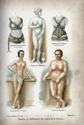 女性の体の美しさと奇形：痩せすぎの女性と、"理想の女性 "とされるメディシスのヴィーナス以下の肥満体。