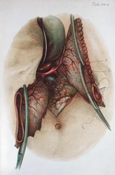 オットー・ズッカーカンドル博士（1861-1921）の「Atlas and Epitome of Operative Surgery」（1910年）の図版（彩色済み彫刻）。