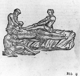 1560年頃の "Traité Médical d