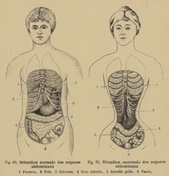男性と女性の腹部の内臓の正常な状態