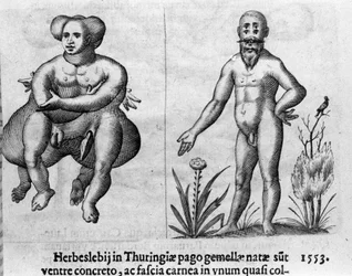 さまざまなタイプの人間の怪物。イタリアの科学者Fortunio Liceti (1577-1656)の「De monstrorum natura, causis et differentiis」からのエングレーヴィング。1646