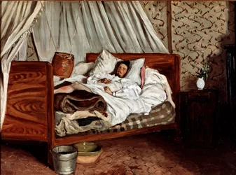 即席の救急車（クロード・モネの傷）。ジャン・フレデリック・バジーユ（1841-1870）の絵画