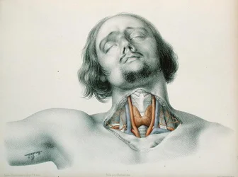 喉の断面図（Jean-Baptiste-Leon Dubreuil著「動脈の異常」より