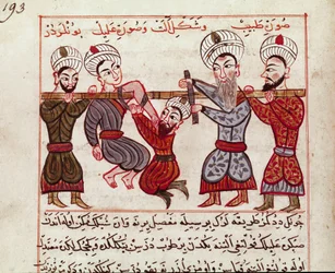 医学：整形外科的介入。Charaf-ed-din (Charaf ed Din) (1404-1468)によるトルコ医学の乳液から抜粋したミニチュア。"La Surgery Imperiale" (Ms Sup Turk 693 fol. 193) 1466 Paris, B.N.