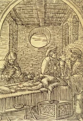 薬草の投与、1534