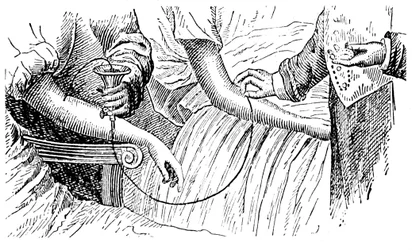 輸血、c1880