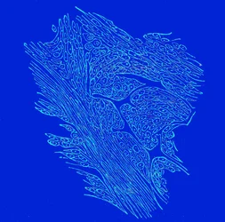 線維性核腫瘍の横断面