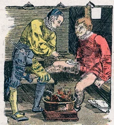 1528年に傷をつける外科医。