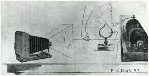 放射線診断、X線写真 X線写真